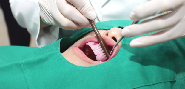 플란 플러스케어 2