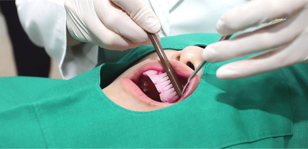 플란 플러스케어 2