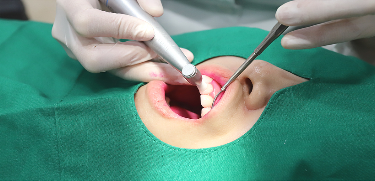 플란 플러스케어 3